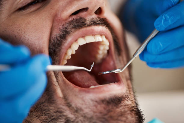 Best Emergency Broken Tooth Repair in Comanche, OK
